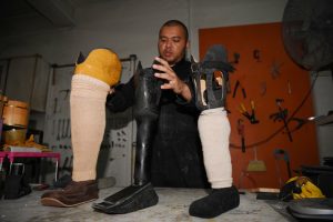 Social enterprise offers prosthetic limbs at half price